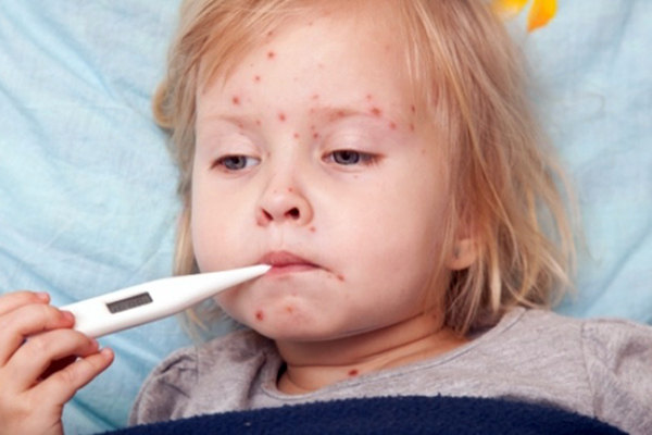 МЗ призовава да ваксинираме децата срещу морбили, ако все още не сме го направили