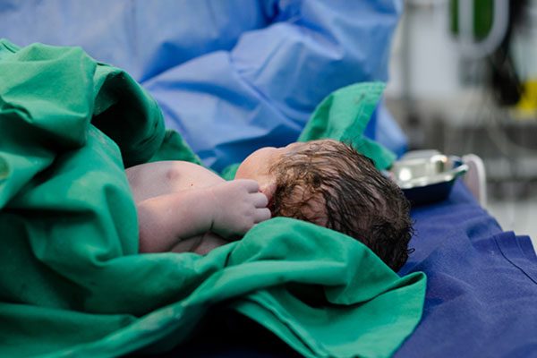 По какво се различават бебетата, родени с операция от останалите