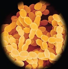Streptococcus thermophilus