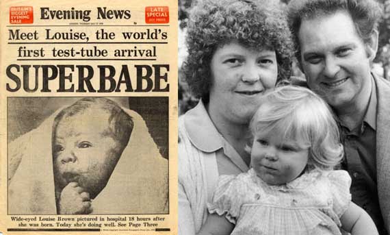 Днес преди 33 години се ражда първото „ин витро” бебе
