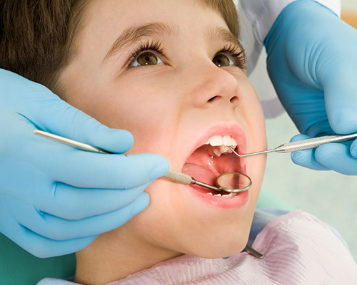 Безплатно поставяне на силанти на постоянните зъби на деца от 5 до 8 години