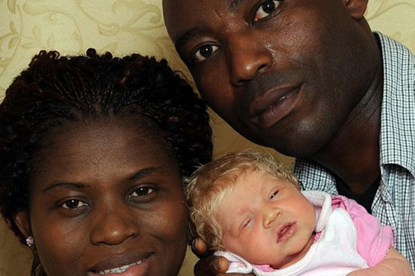 Бяло бебе със сини очи зарадва чернокожи родители